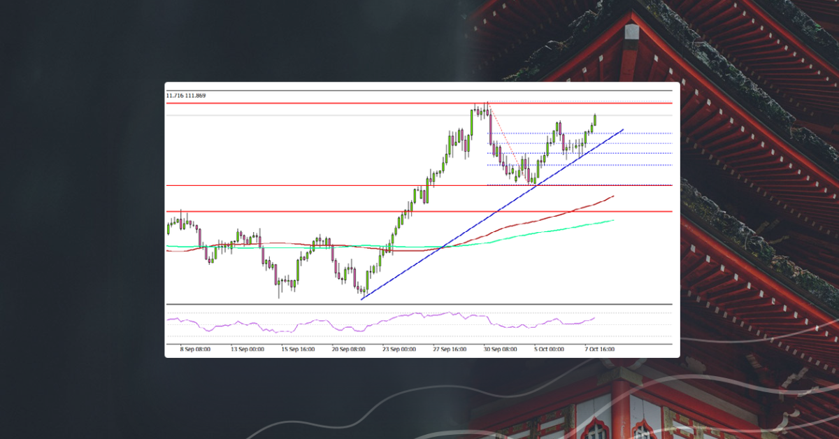 USD/JPY Remains Elevated, US NFP Next